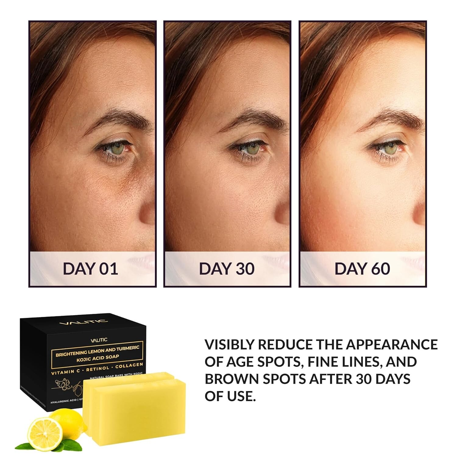Gentle Daily Cleanser: Brightening Kojic Acid Soap with Antioxidants – 2 Pack