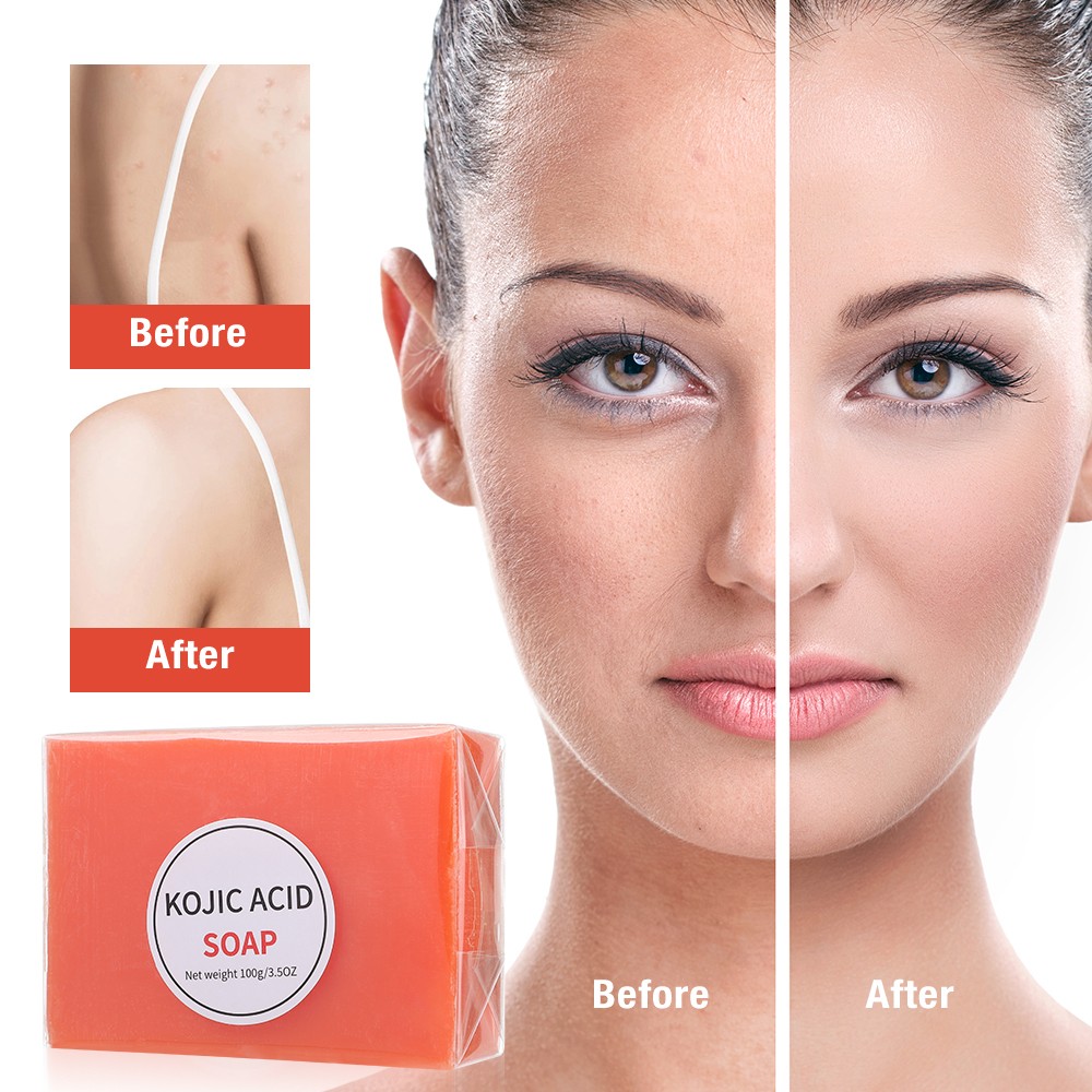 Kojic Acid Soap Handmade Essential Oil Soap Bath Soap Cleanses Skin Mites Remova
