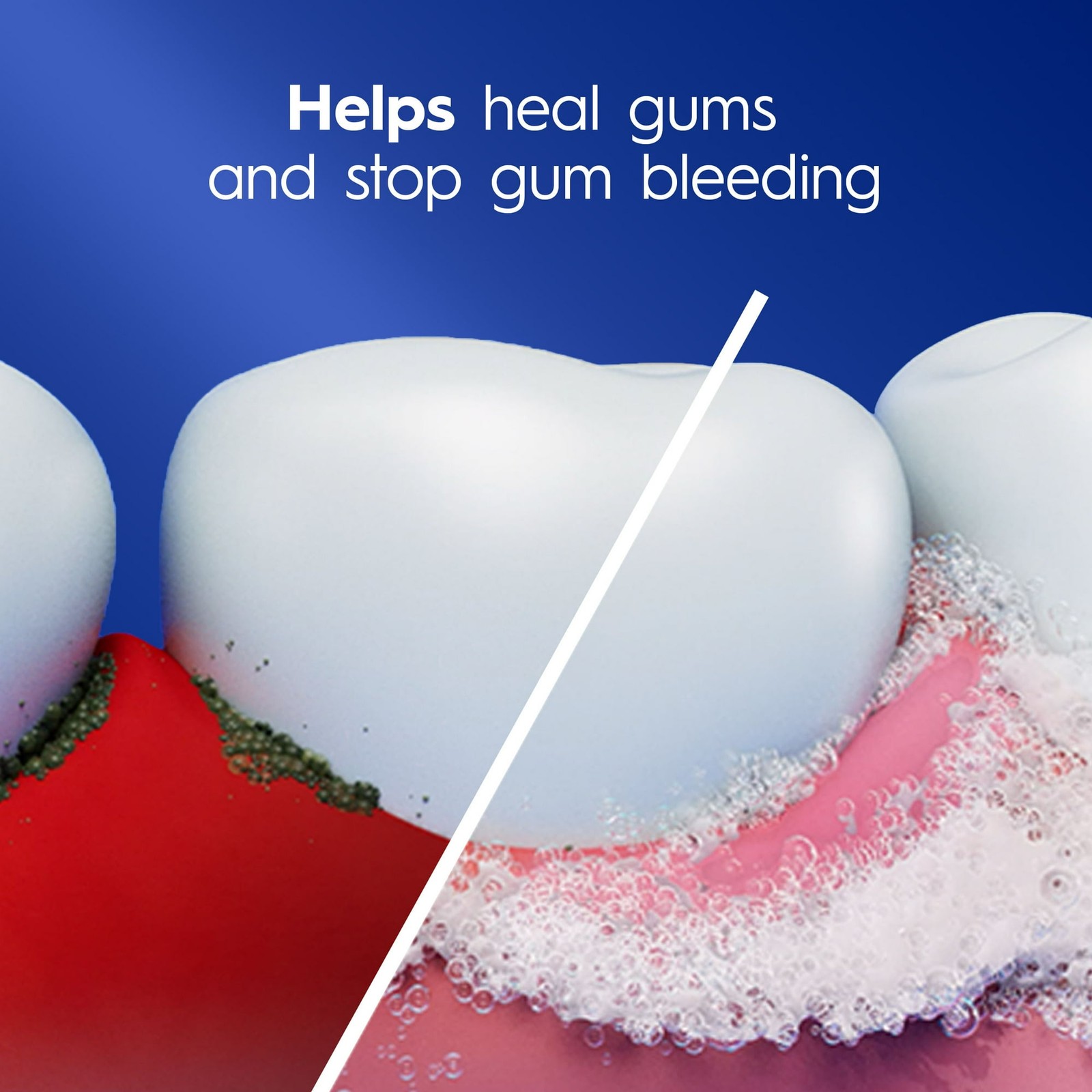 Crest Pro-Health Gum Detoxify Deep Clean Toothpaste 4.8 oz