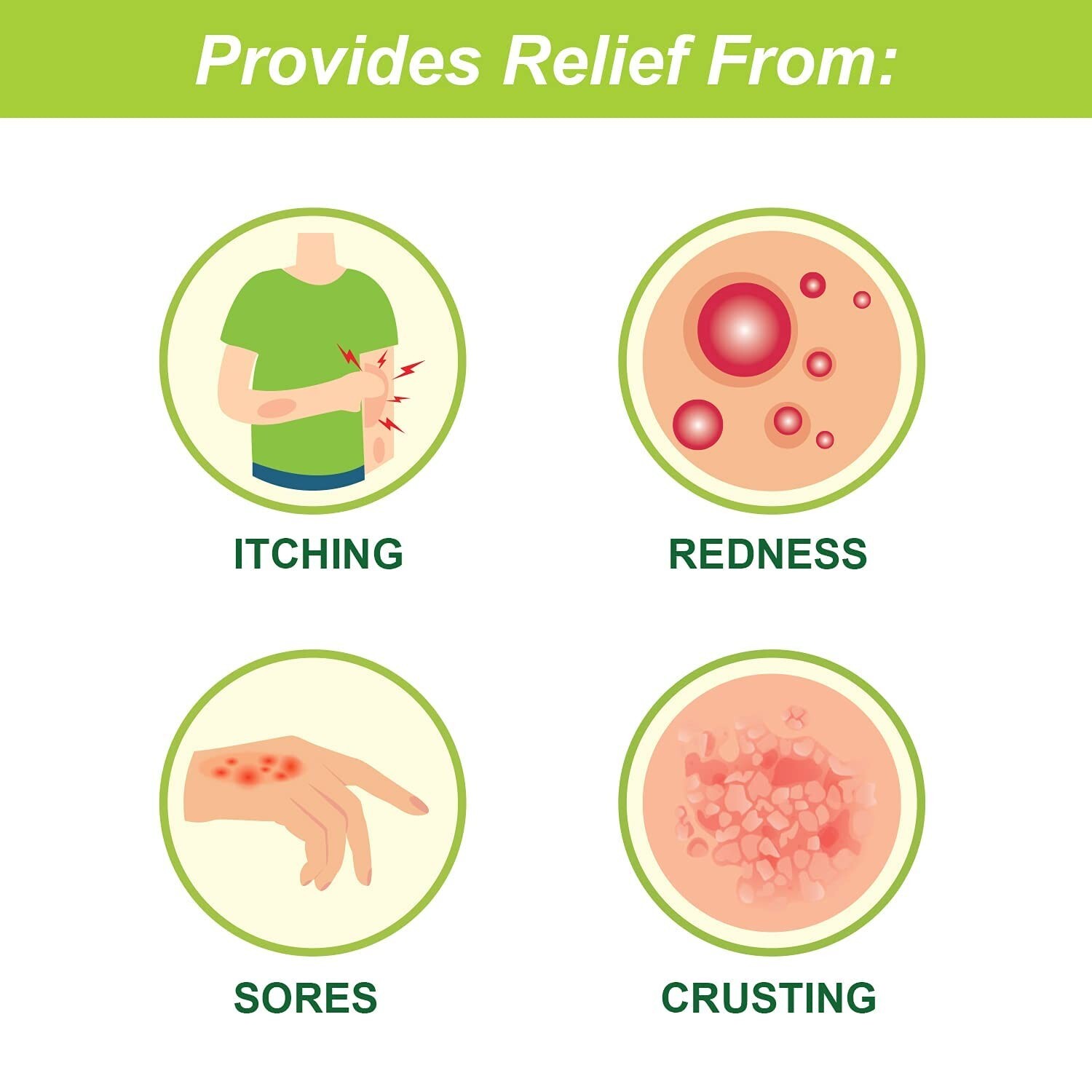Tetmosol Soap, Fights Skin Infections & Itching, Lime Scent,Pack of 12 (12x100g)