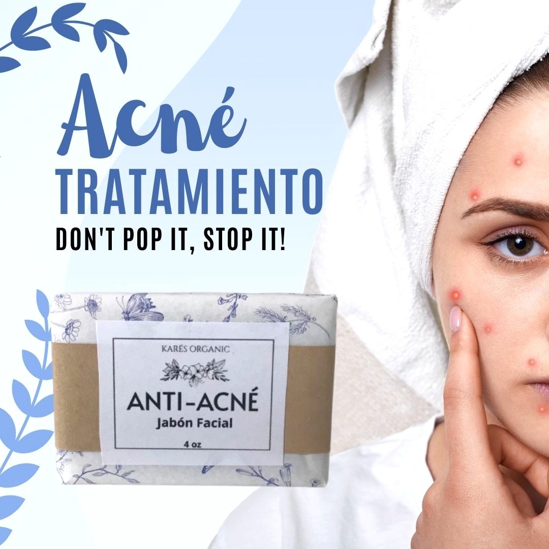 JABON FACIAL ANTI-ACNE ELIMINA GRASA, ESPINILLAS,GRANOS, PUS Y ENROJECIMIENTO!