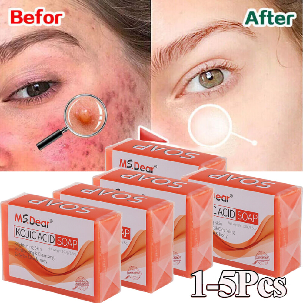 Kojic Acid Dark Spot Remover Soap Bars with Vitamin C Retinol, Collagen Turmeric