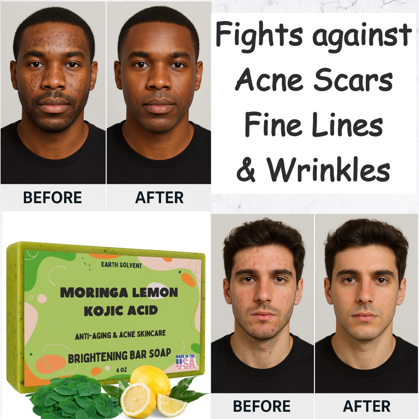 Moringa Lemon Kojic Acid Brightening Bar Soap for Acne, Wrinkles & Anti Aging