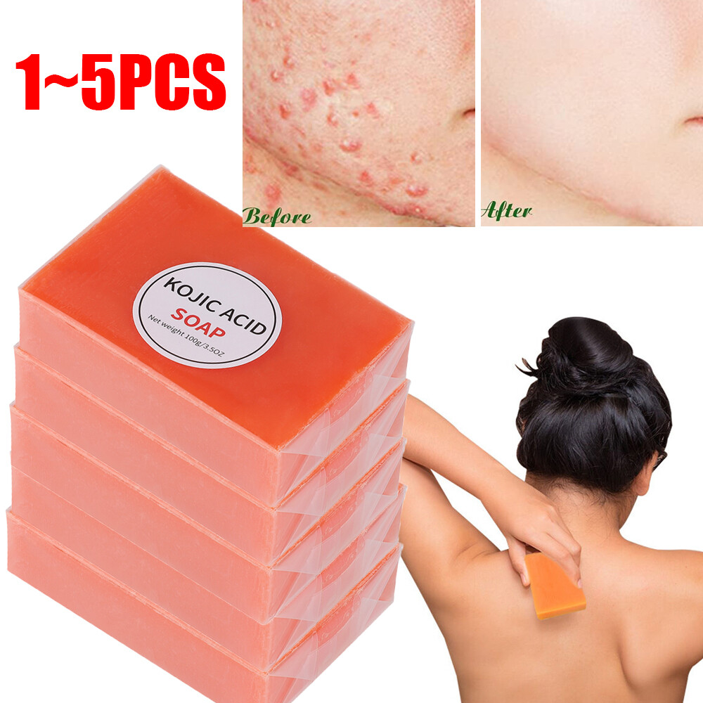 Skin Lightening Kojic Acid Soap Remove Dark Spots Acne Whitening for Face & Body