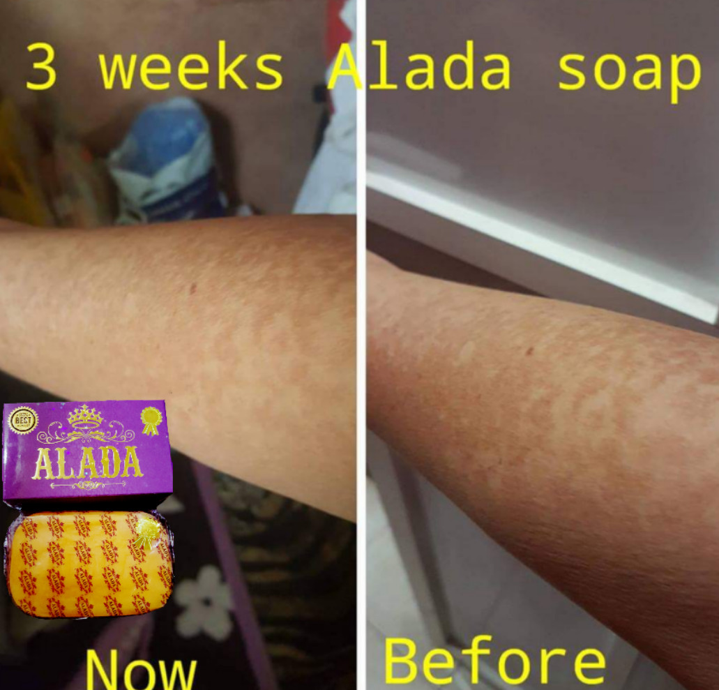AUTHENTIC ALADA Whitening Soap AUTHENTIC NATURAL SOAP 160 g.