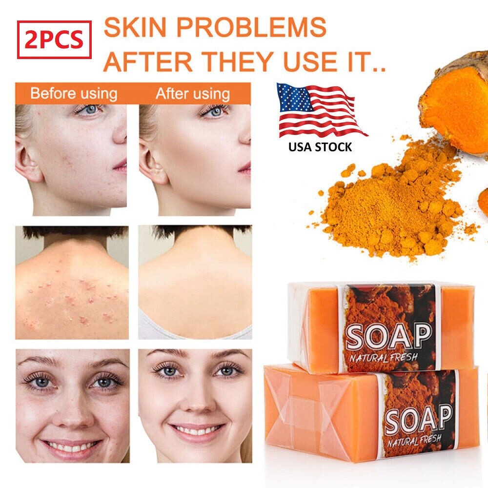 3PCS Tumeric Soap Skin Whitening Dark Spots lightening Acne Brightening Turmeric