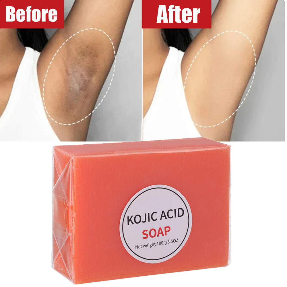 5/3x Kojic Acid Soap Dark Spot Whitening Bleaching Lightening Face & Body Skin