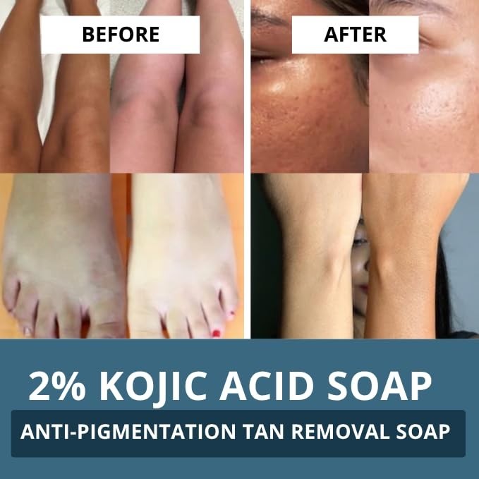 BAKE Kojic Acid 2% Soap 200g With Alpha Arbutin & Niacinamide | For Men & Women