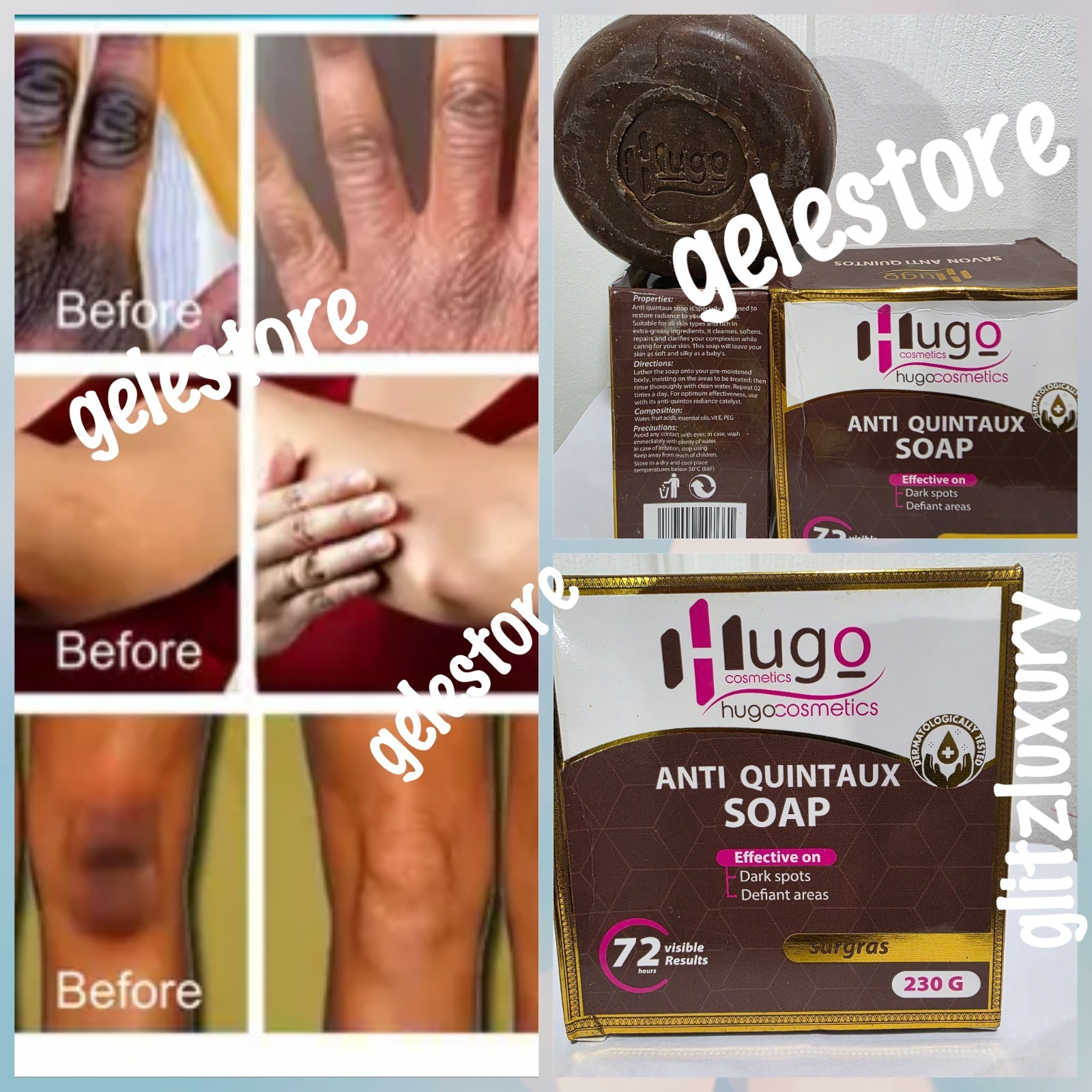 1 soap: Hugo anti Quintaux Soap. Effective on dark spots. 230g x 1.
