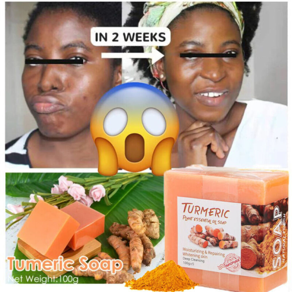 Tumeric Soap For Dark Spots, Skin Lightening, Anti Acne Skin Cleansing Soap Bar~