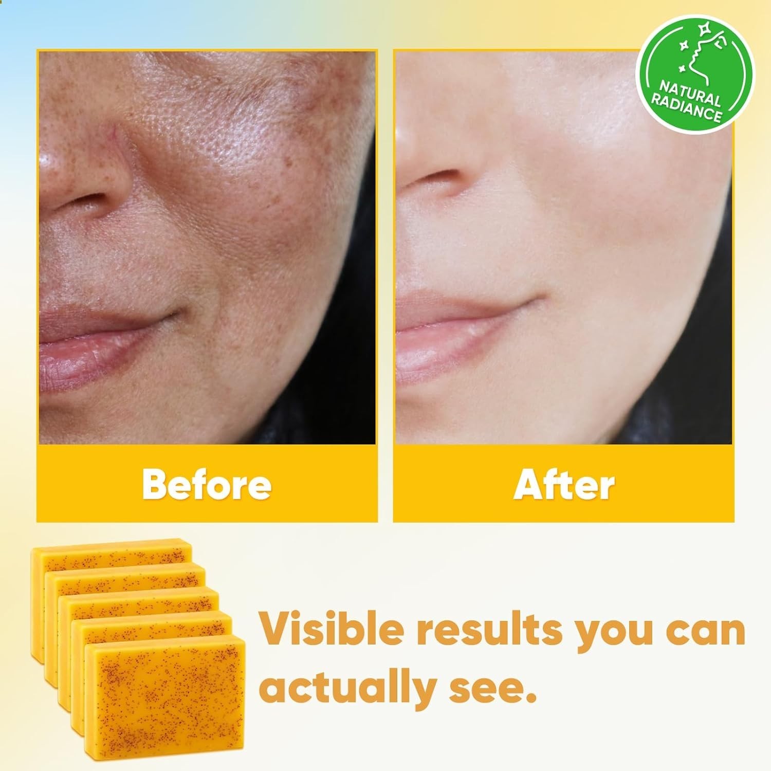 5 Jabones De Curcuma 3.5 oz Para Las Manchas El Acne En La Cara y Aclarar Piel