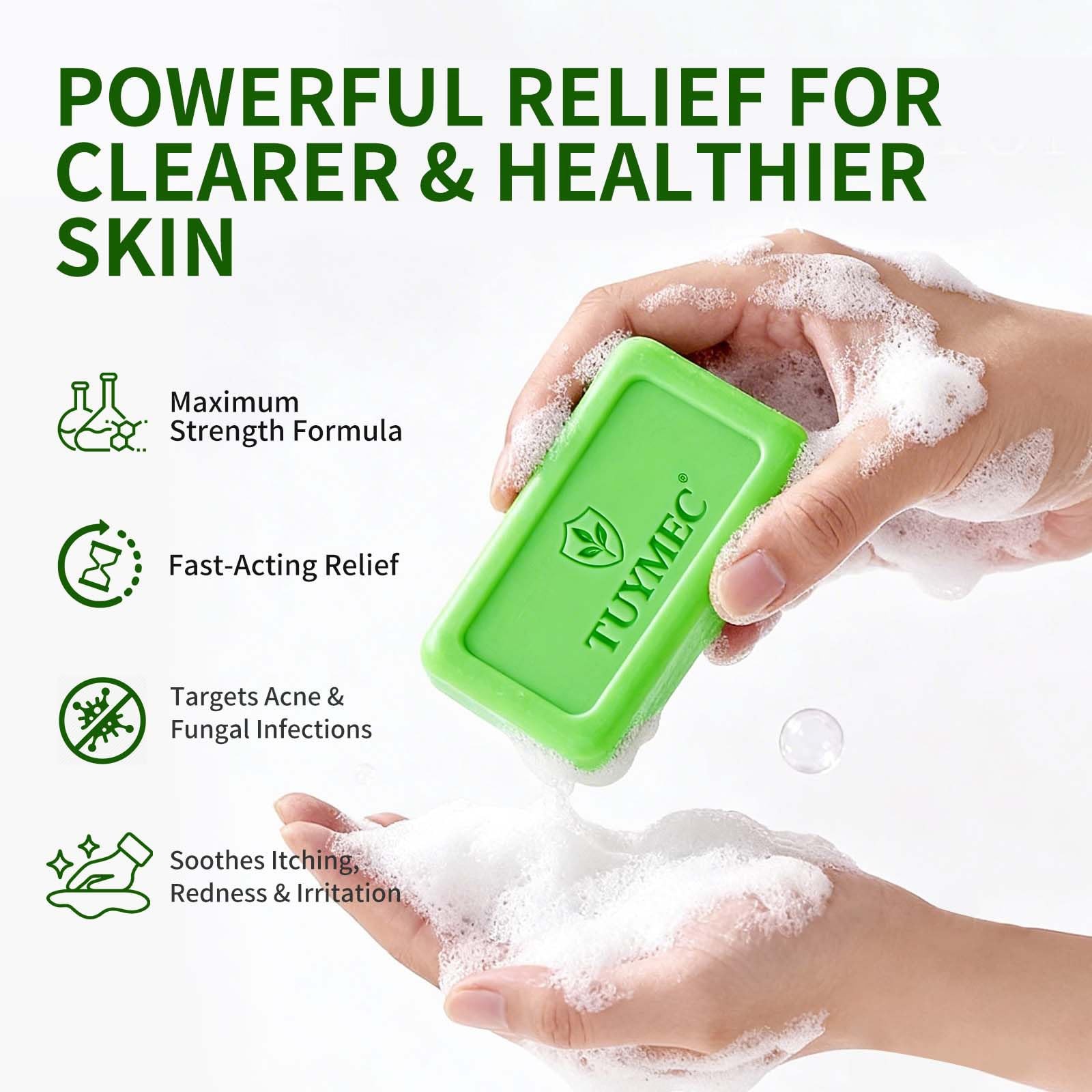 Antifungal Bar Soap Skin Fungus Treatment for Athlete’s Foot, Jock Itch & Ri…
