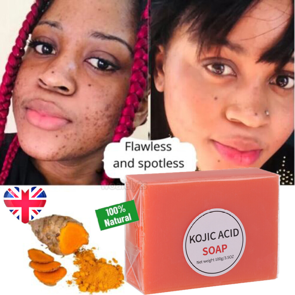 Original Kojic Acid Soap for Dark Spots Whitening, Turmeric Soap Skin Lightening
