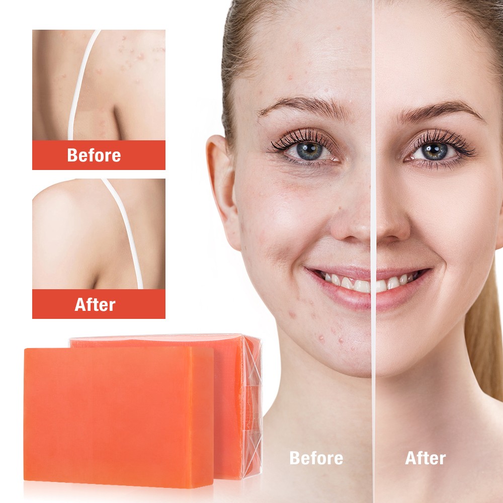 2XKojic Acid Essential Oil Soap Refreshing Moisturizing Cleaning Handmade Soap