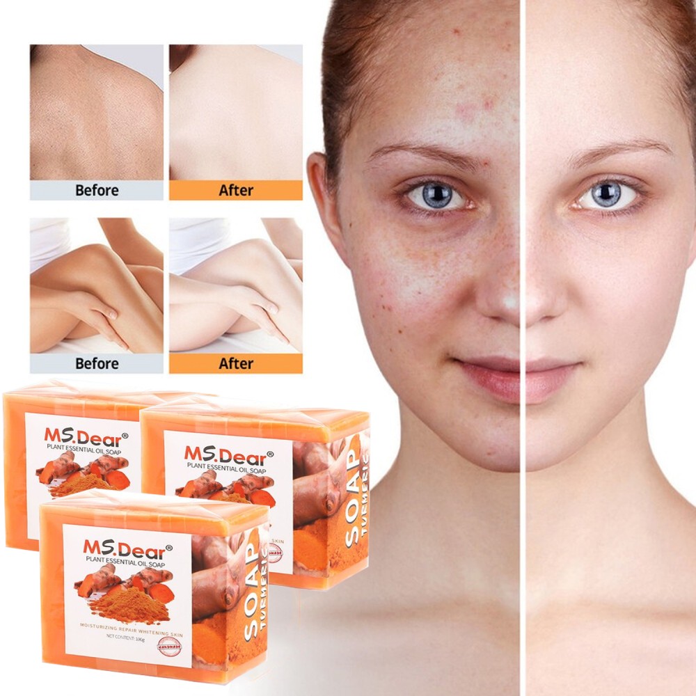 3X Turmeric Kojic Acid Soap Skin Brightening Dark Spot Remover w/Hyaluronic 100g