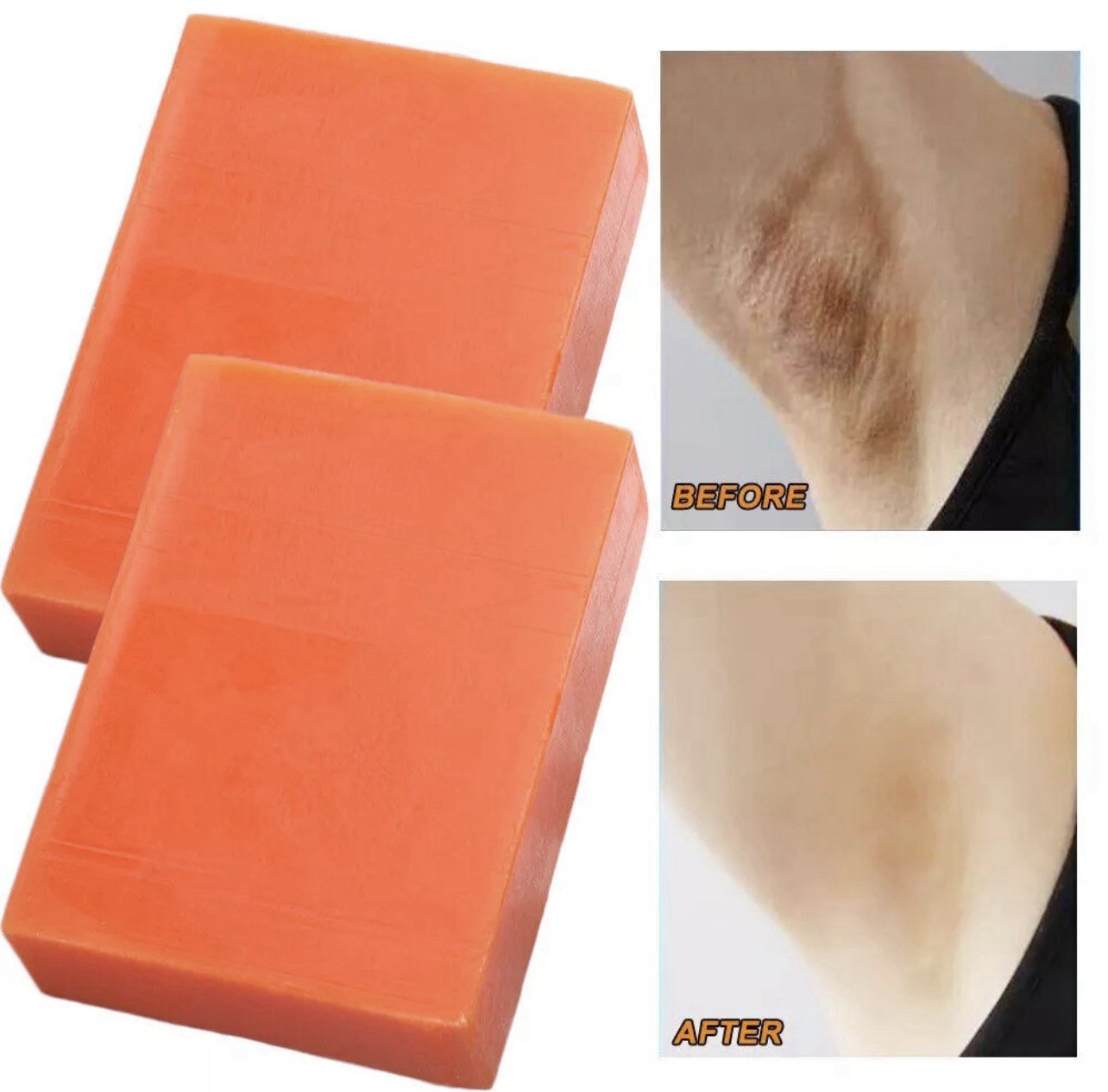 3 Kojic Acid Soap Dark Skin Whitening Bleaching Lightening Yoni Inner Thigh