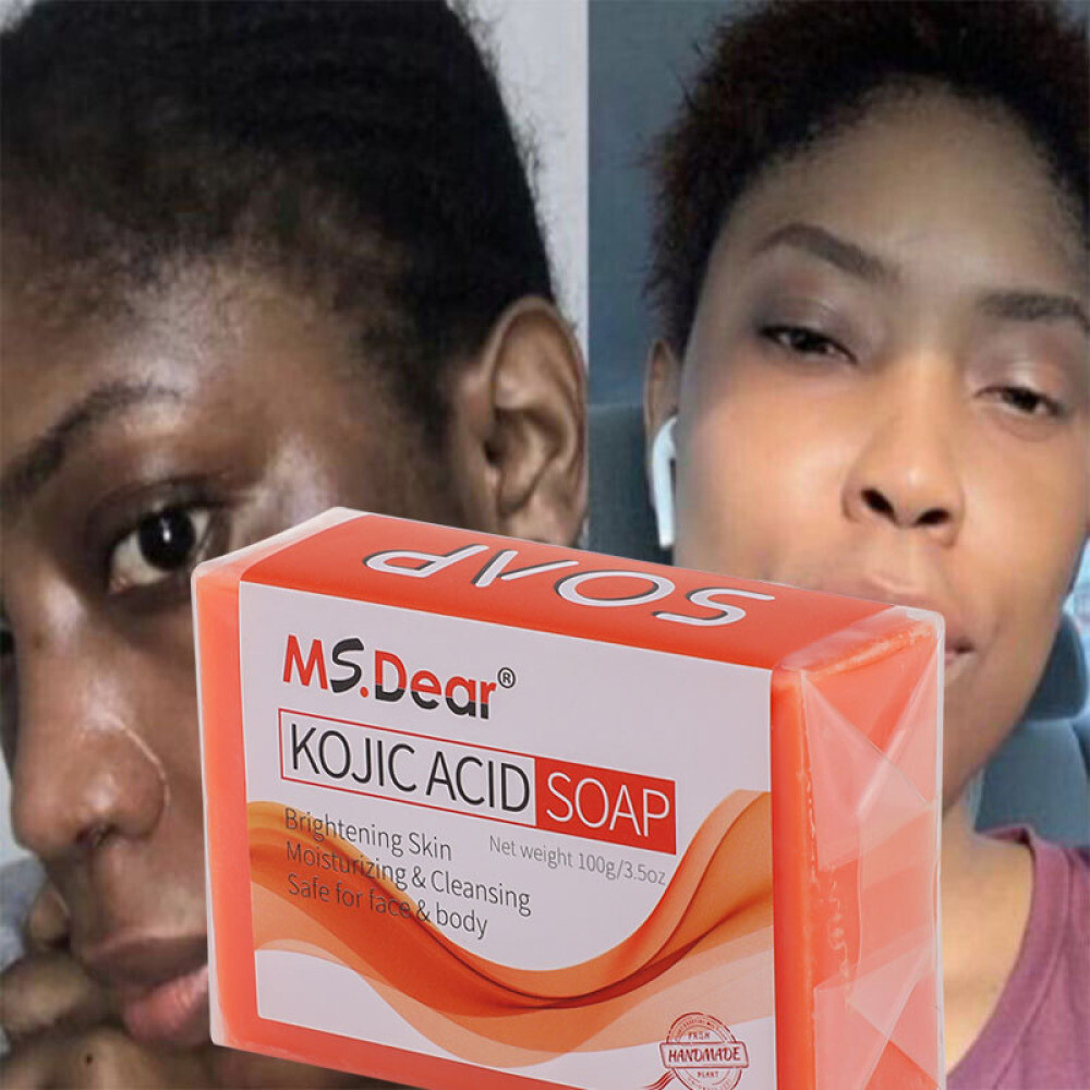 Kojic Acid Skin Whitening Soap Acne Lightening Bar 100g Facial Body Care Soap