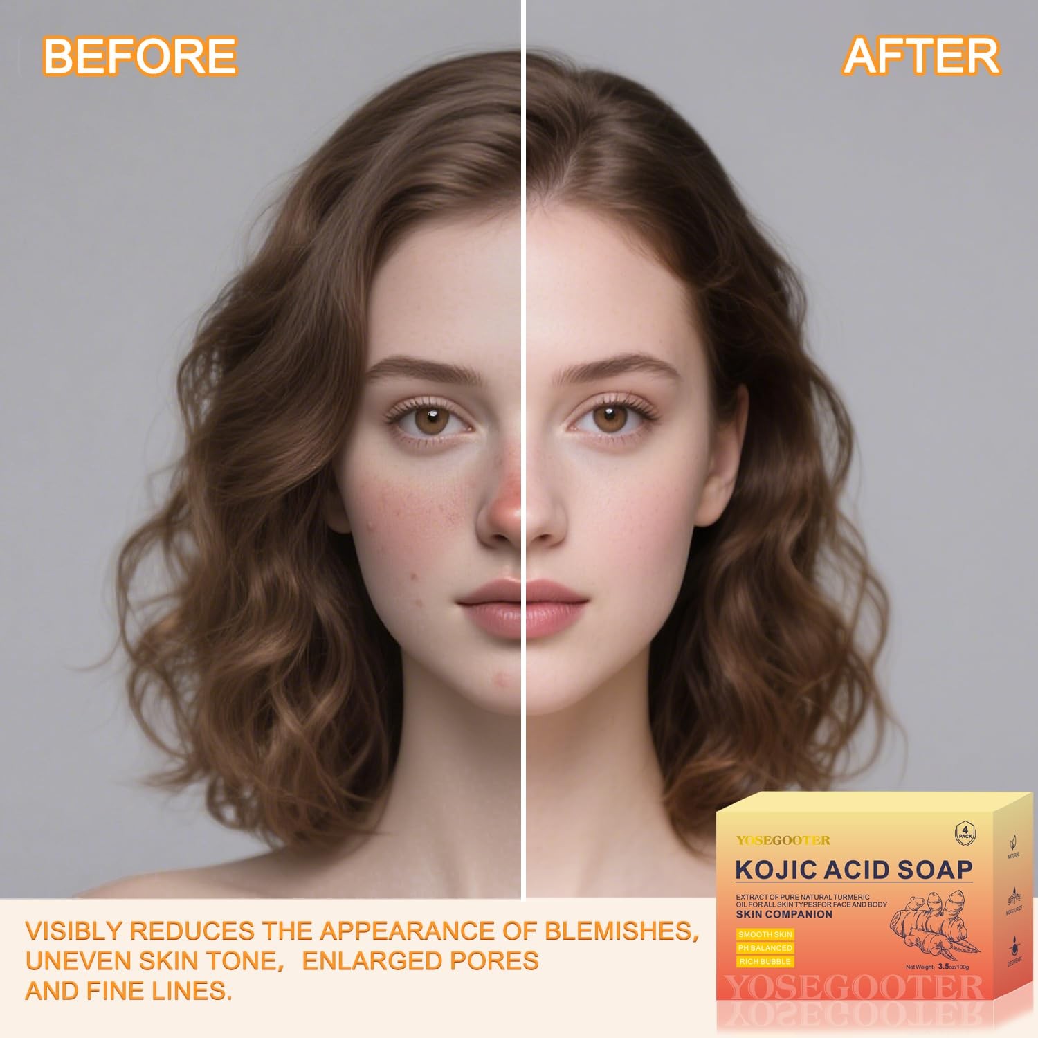 Kojic Acid Turmeric Soap 4Pack 100g Dark Spot Remover Skin Brightening