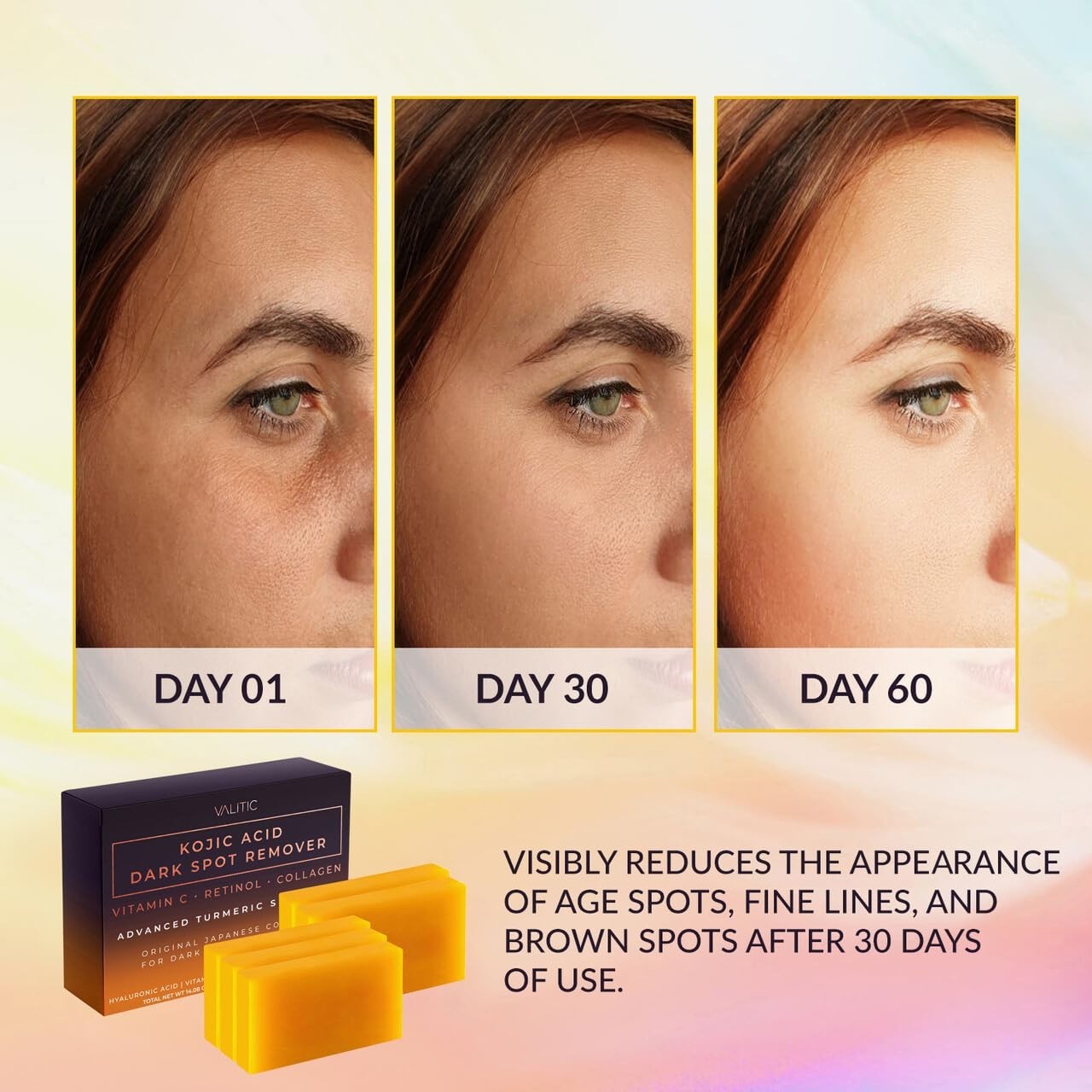 Revitalizing Kojic Acid Soap with Turmeric & Shea Butter – 5 Bars for All Skin