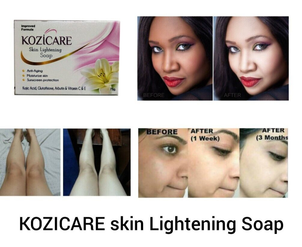 2X Kozicare Skin Lightening Soap, 75g,Sunscreen Protection Keeps Skin Young