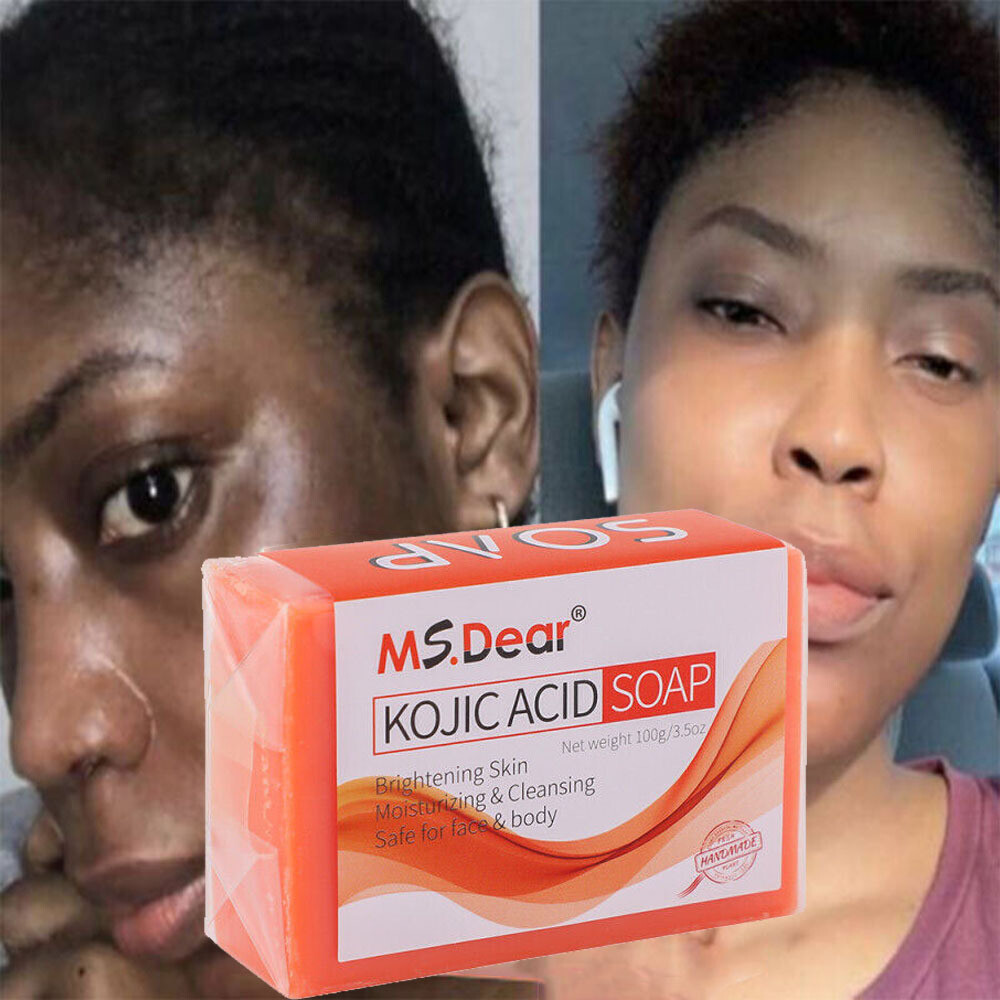 Kojic Acid Soap Dark Skin Whitening Bleaching Lightening Brightening Face & Body