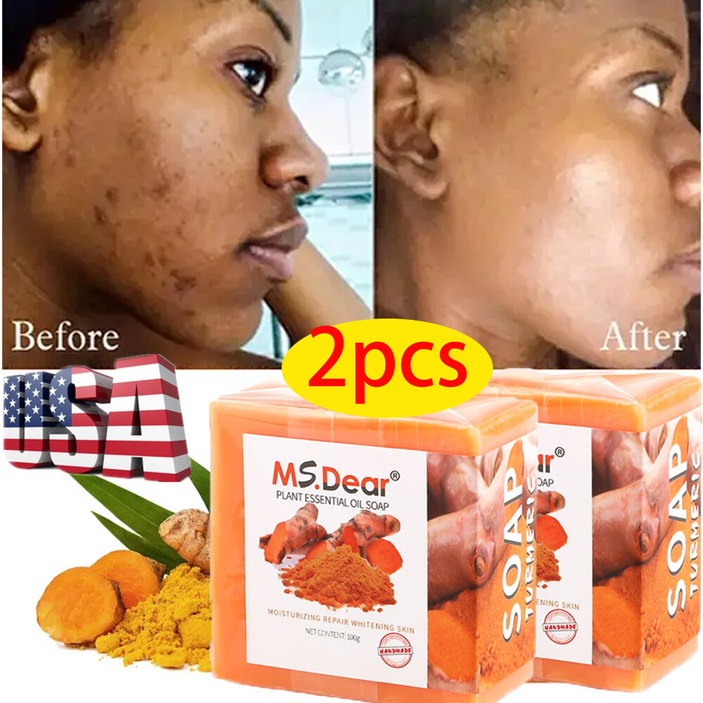 2× Tumeric Soap Skin Whitening Dark Spots lightening Acne Brightening Turmeric