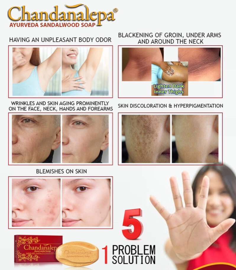 Chandanalepa Ayurveda Beauty Soap Spice Pieces & Scent of Sri Lankan Sandalwood