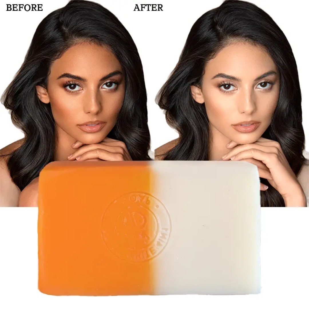 4-Pk Kojic Arbutin Brightening Bar Soap Skin Dark Spot Remover 160g [USA Stock]