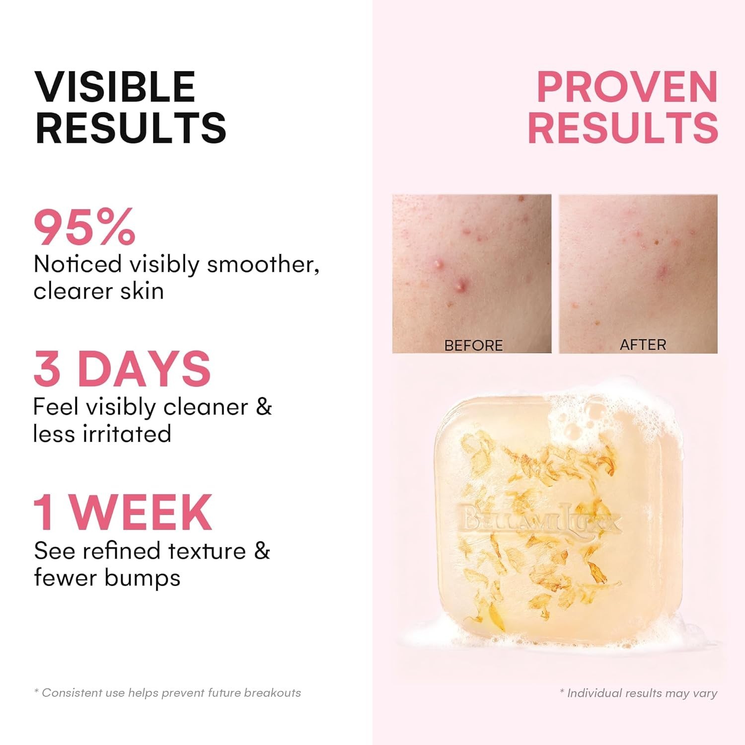 BellamiLuxx Body Acne Soap Bar Set of 2 Antibacterial Folliculitis & Fungal NIB