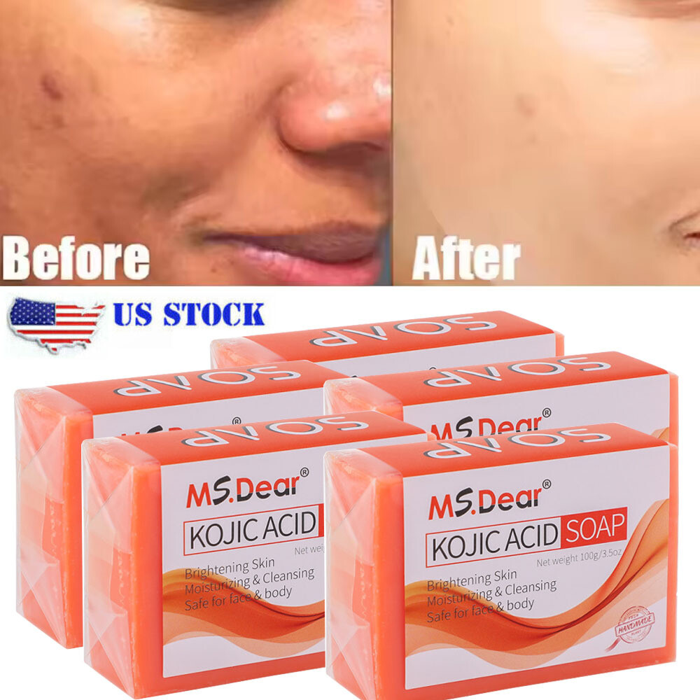 5/3X Skin Brightening Soap Original Kojic Acid Soap for Dark Spot Whitening 100g