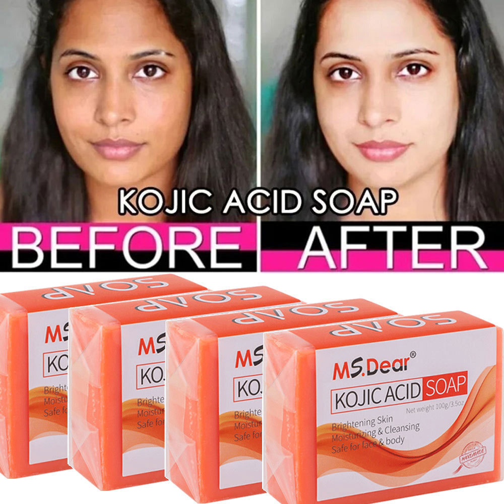 100g Acid Soap Dark Spot Remover Skin Lightening Face Whitening Body Bleaching
