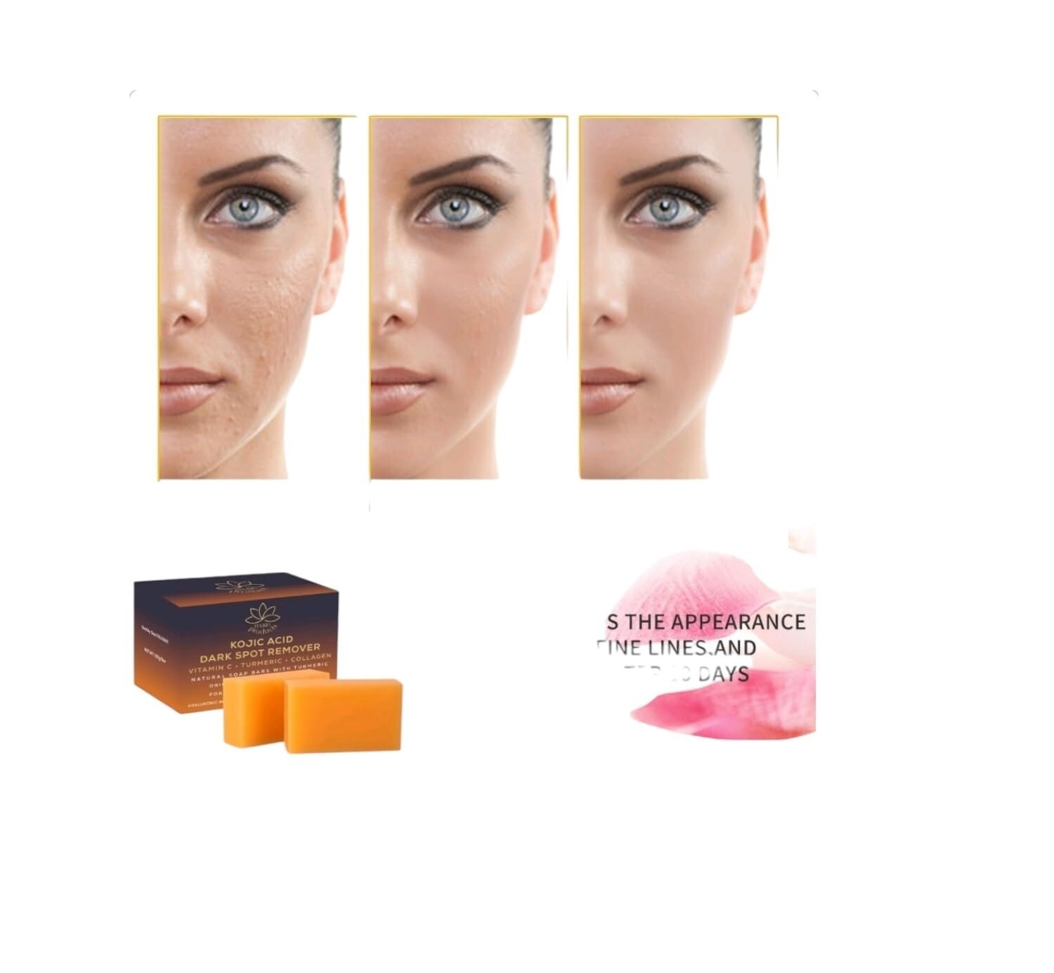 Kojic Acid Dark Spot Remover Soap Bars with Vitamin C Retinol, Collagen Turmeric