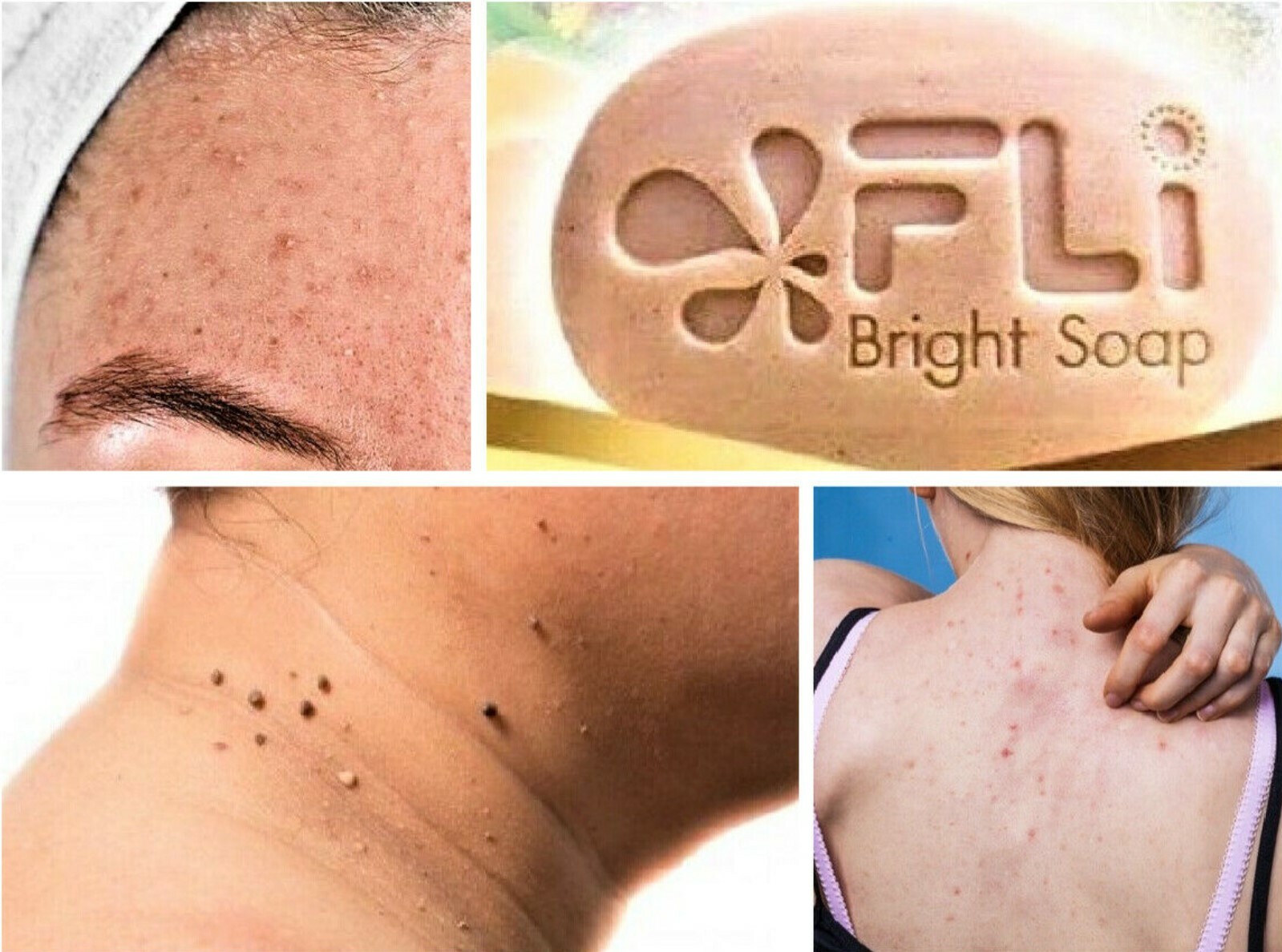 6x FLI Bright Soap Whitening Skin Legendary 9 Thai Herbal Face Body Health
