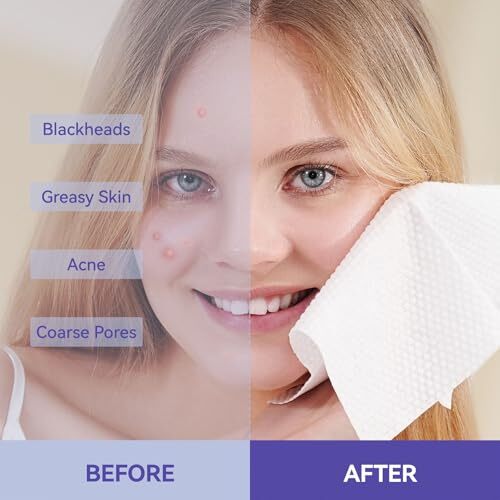 Disposable Face Towels, Face Towelette Disposable, Soft Makeup Remover Dry