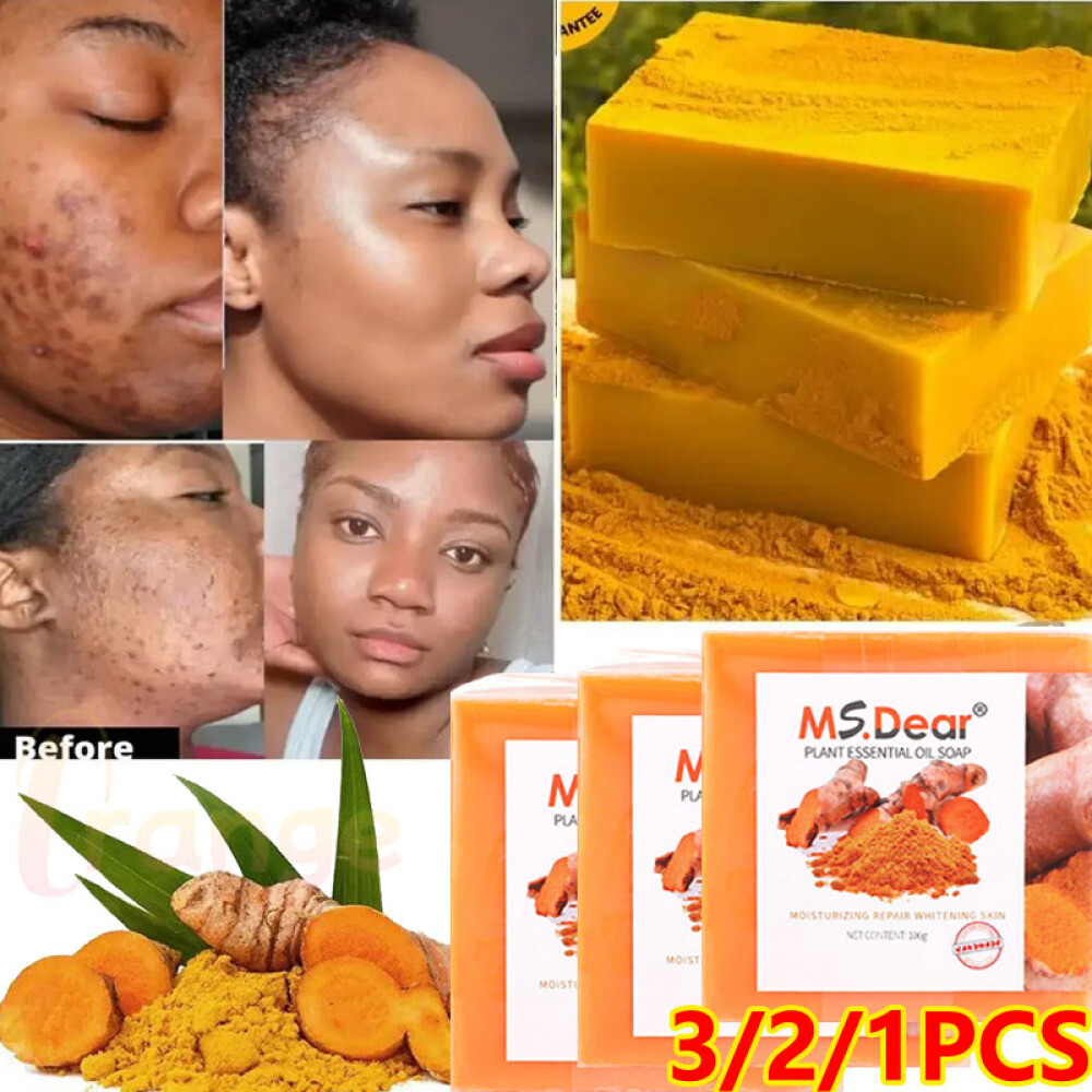 3/2× Tumeric Soap Skin Whitening Dark Spots lightening Acne Brightening Turmeric