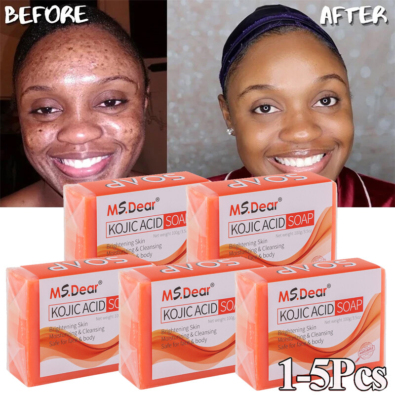 Kojic Acid Soap Dark Spot Whitening Turmeric Soap Skin Bleaching Lightening 100G