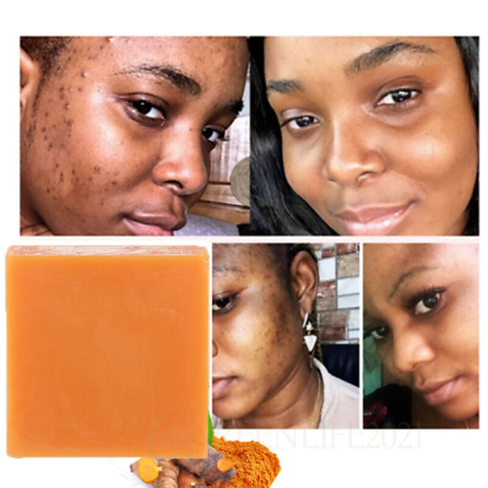 4PCS Tumeric Soap Skin Whitening Dark Spots lightening Acne Brightening Turmeric