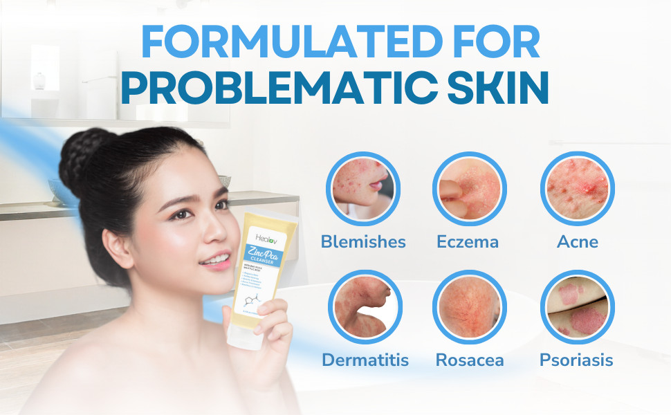 Zinc Face Wash | Zinc Soap Skin Therapy Body Cleanser for Acne, Rosacea, Eczema,