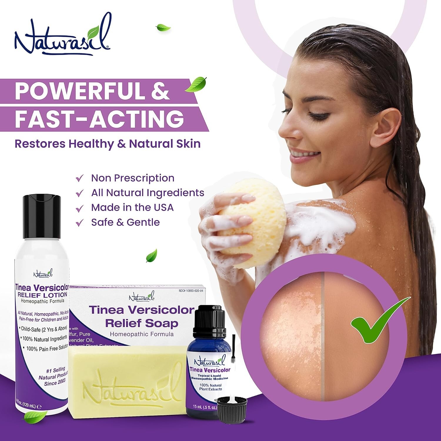 Naturasil Tinea Versicolor Treatment +2 Bars | Max-Strength 10X Soap | Antifunga
