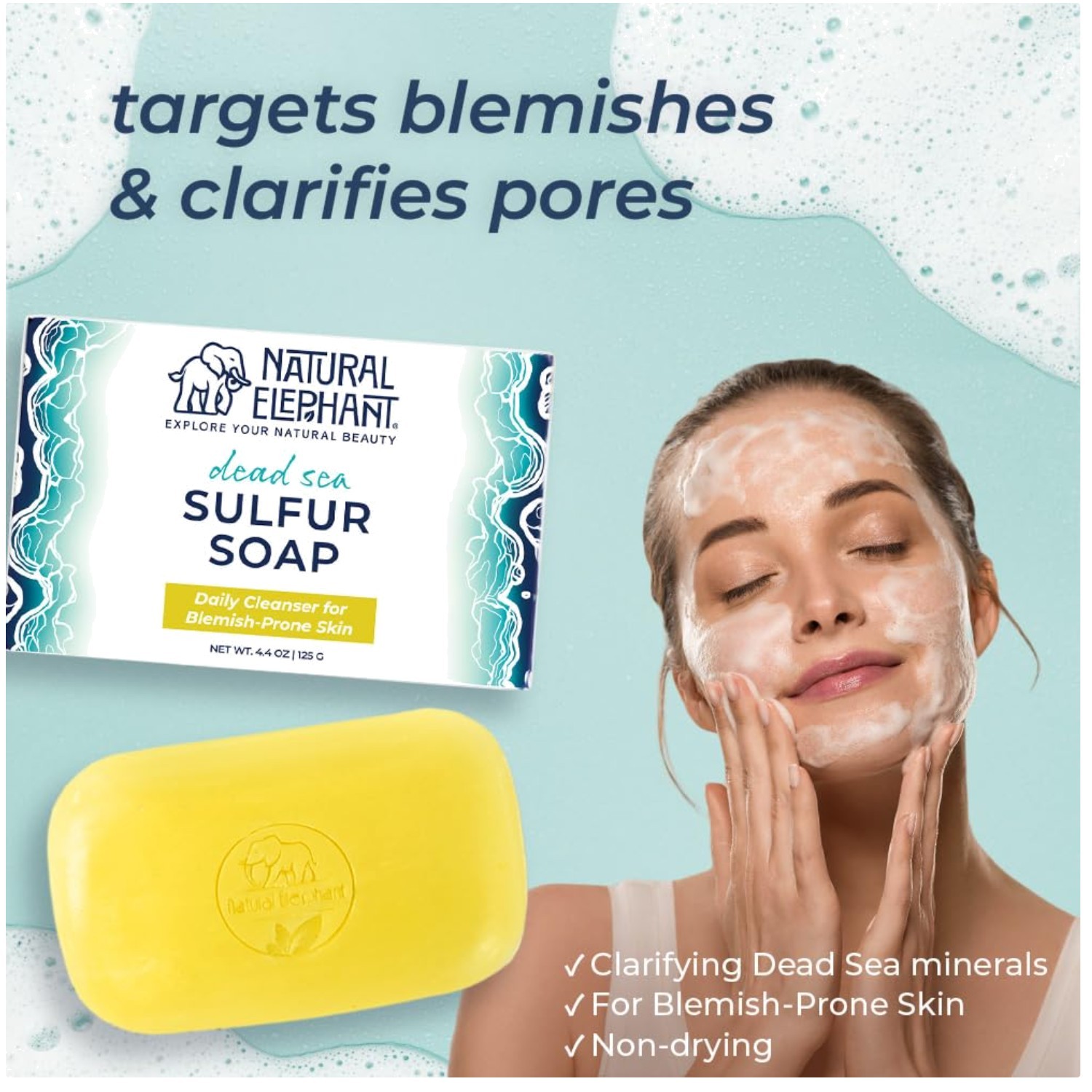Acne Prevention Sulphur Soap Bar 6-Pack
