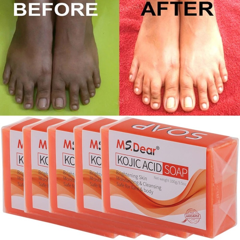 100g Acid Soap Dark Spot Remover Skin Lightening Face Whitening Body Bleaching