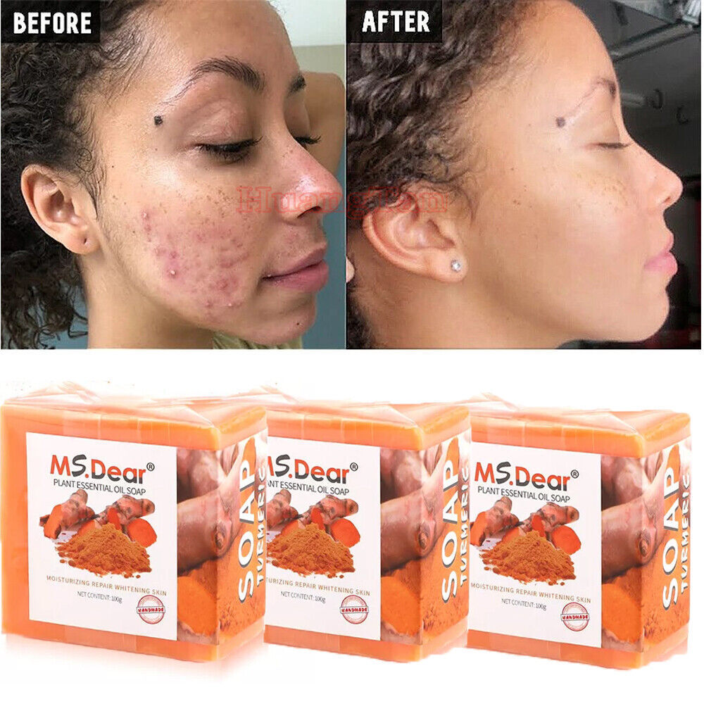 3/2× Tumeric Soap Skin Whitening Dark Spots lightening Acne Brightening Turmeric