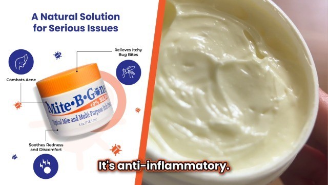 Anti-Itch Sulfur Soap for Mites & Insect Bites | Kid Safe | 5 oz Bars (2)