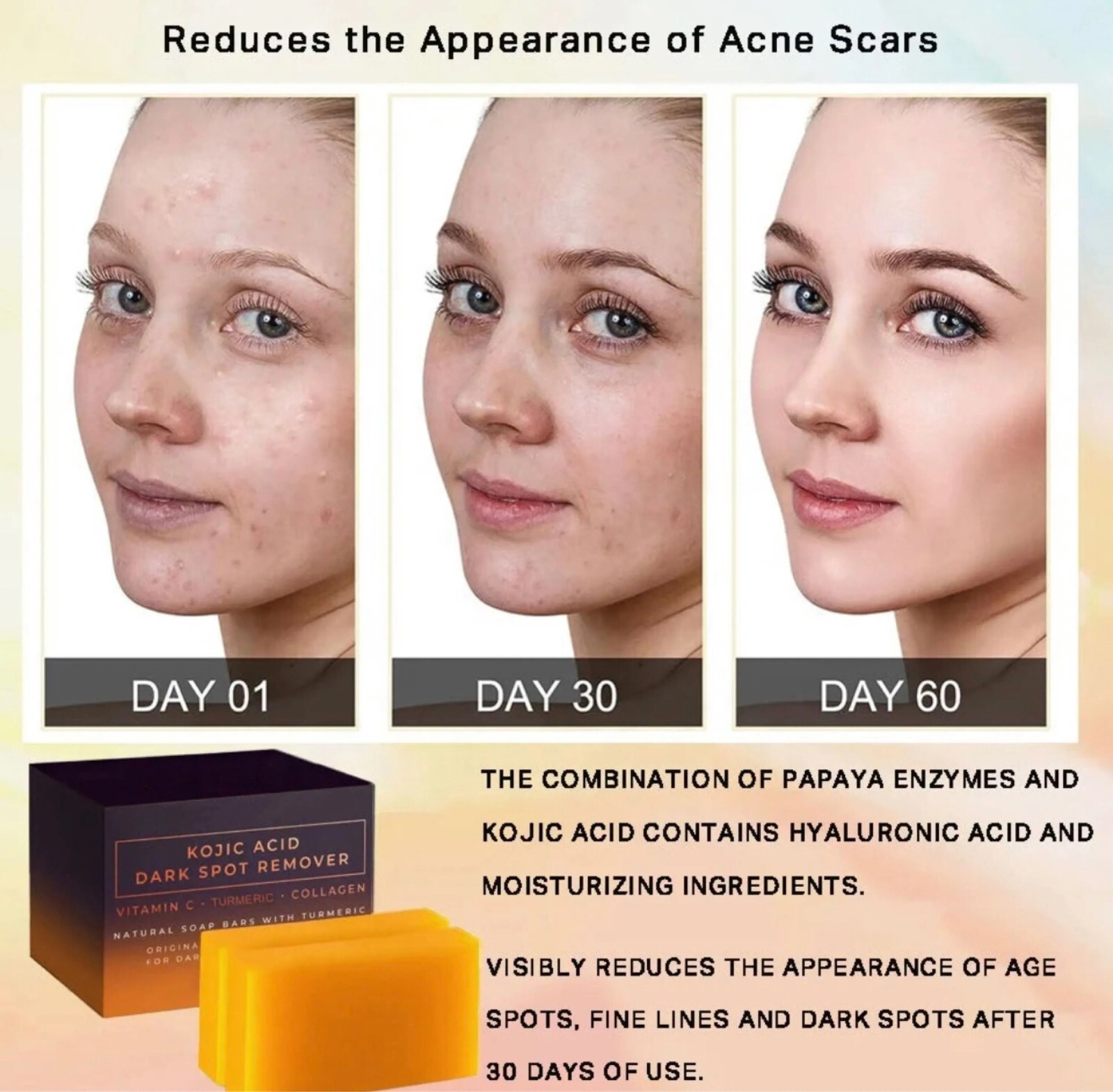 2-Pack Kojic Acid Soap Bars – Dark Spot Remover w/ Vitamin C, Retinol & Collagen