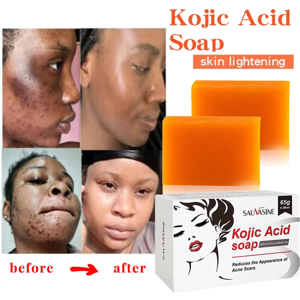 1-5X Kojic Acid Soap Dark Spot Whitening Turmeric Soap Skin Bleaching Lightening
