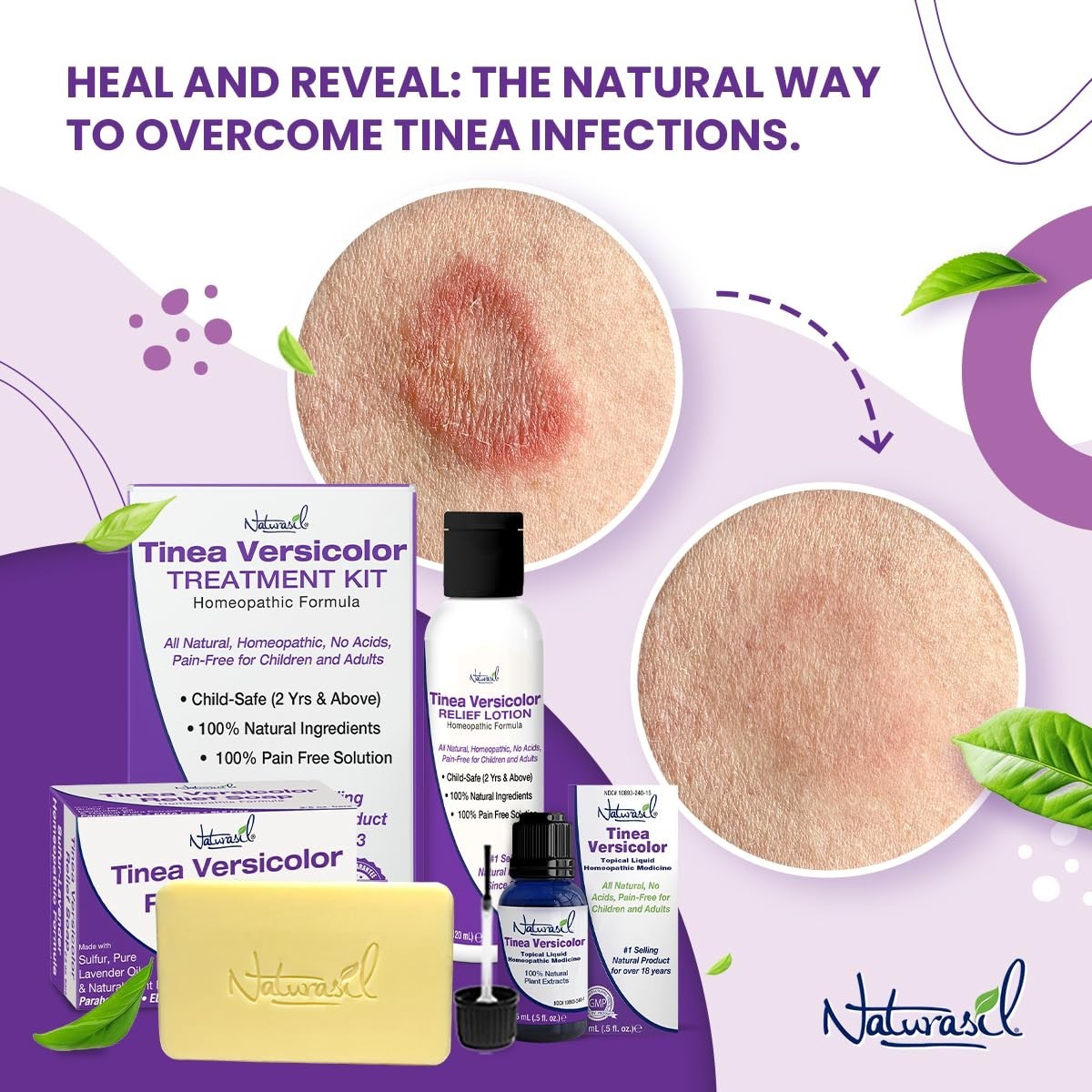 Lavender Scented Antifungal Sulfur Soap – Natural Relief for Skin Irritation