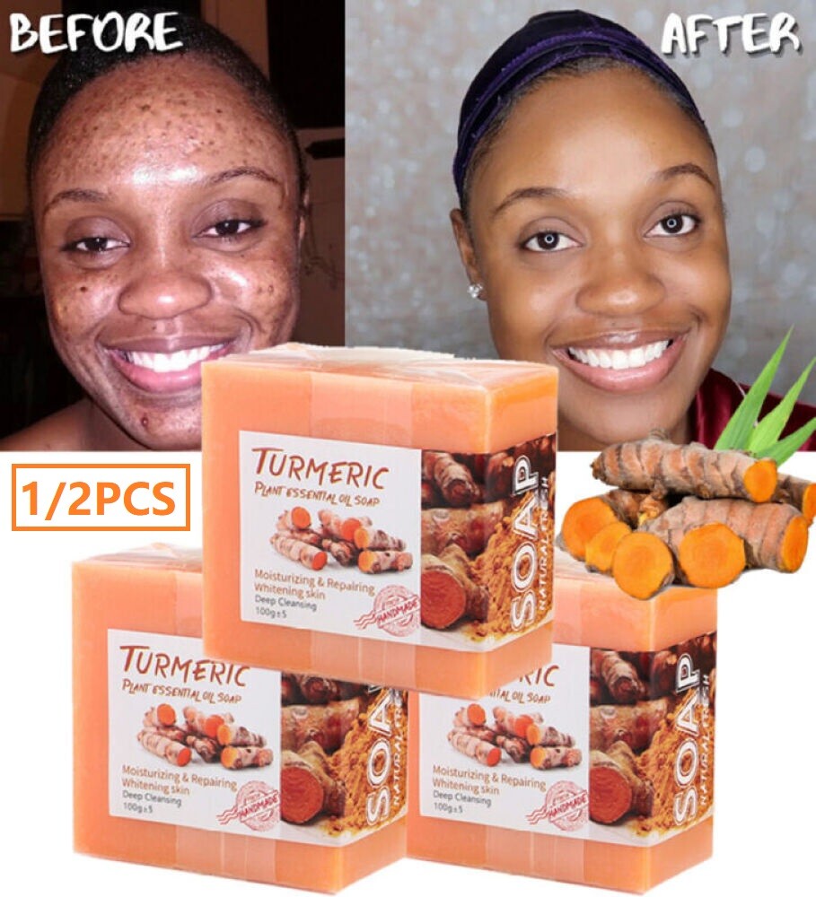 2×Tumeric Soap Ginger Anti-Acne Dark Spots Scars Removal Body Whitening Soap Bar
