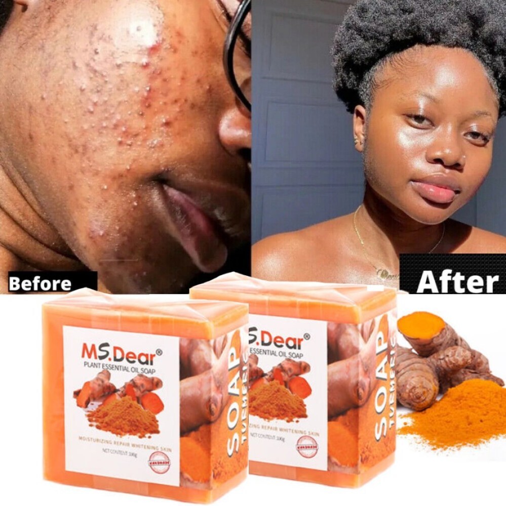 3× Turmeric Soap for Face Body Skin Brightening Anti-Acne Dark Spots Lightening