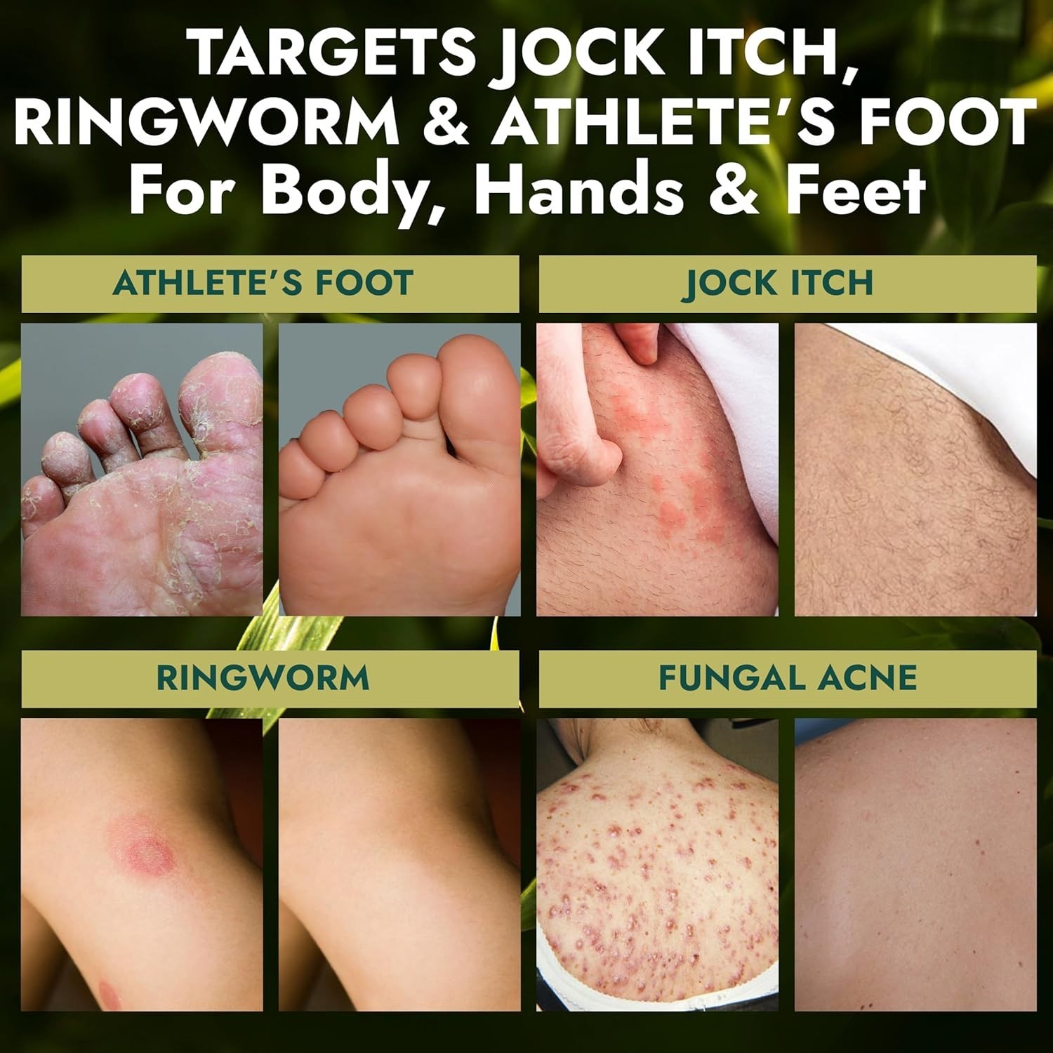 Armor Medicated Antifungal Soap | 1% Tolnaftate Relief