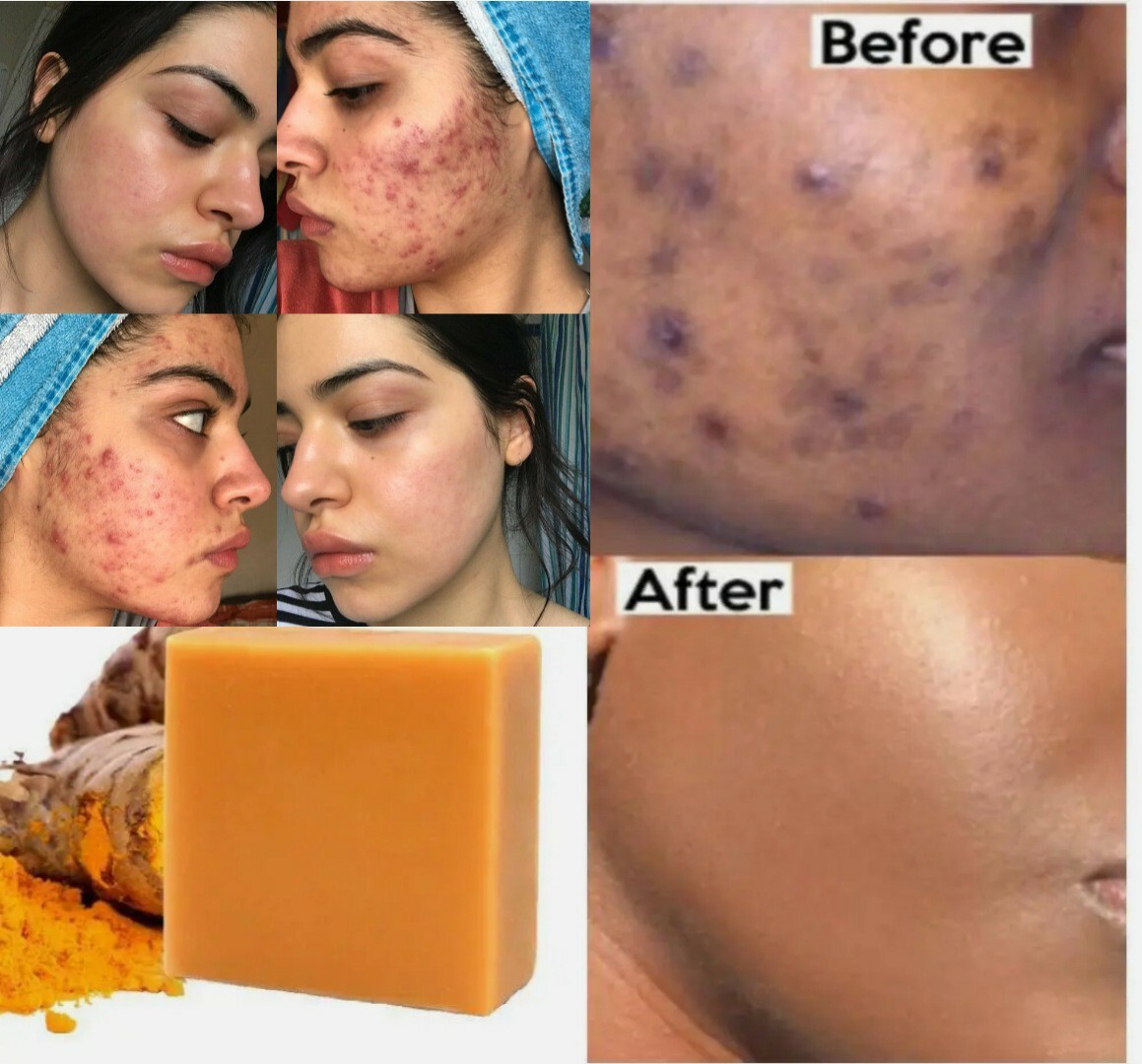 10 Pcs Tumeric Soap, Dark Spots, Skin Glow, Brighter Skin, Scars, All Skin types